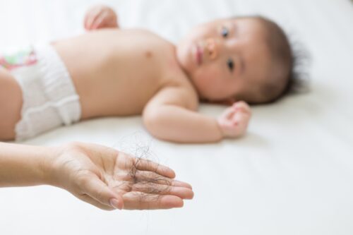 Otras posibles causas de la caída de cabello en bebés